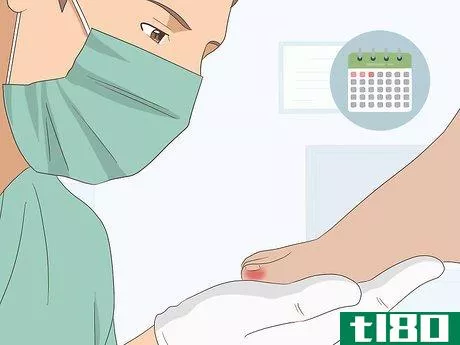 Image titled Relieve Ingrown Toe Nail Pain Step 21