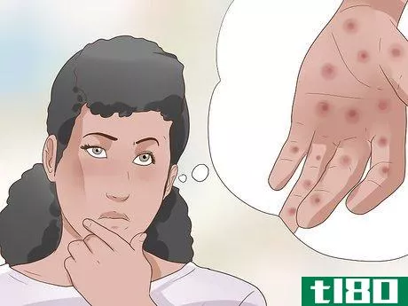 Image titled Recognize Syphilis Symptoms Step 4