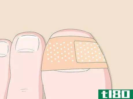 Image titled Relieve Ingrown Toe Nail Pain Step 11