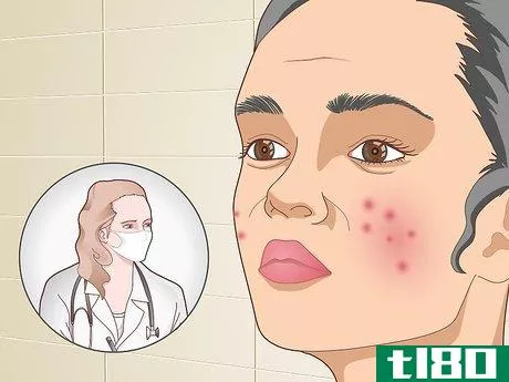 Image titled Prevent Acne Naturally Step 19