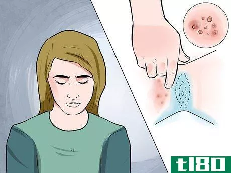 Image titled Recognize Genital Warts Step 1