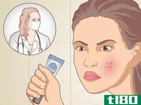 Image titled Prevent Acne Naturally Step 20