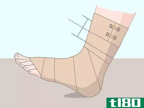 Image titled Wrap an Ankle with an ACE Bandage Step 7