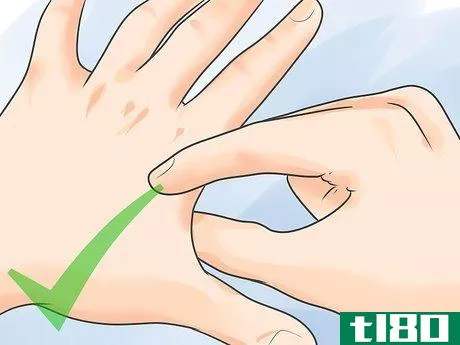 Image titled Use Acupressure Points for Migraine Headaches Step 11