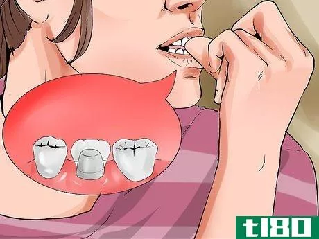 Image titled Avoid Dental Crown Problems Step 13