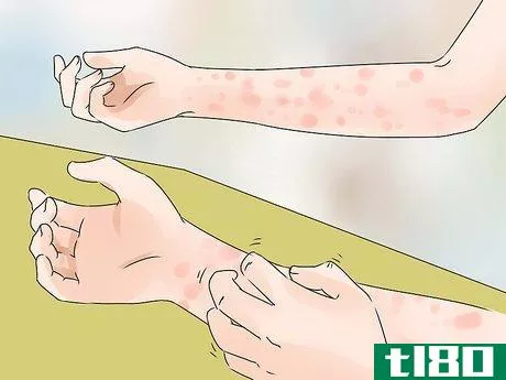 Image titled Avoid Skin Problems at Work Step 1