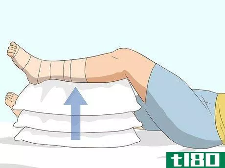 Image titled Wrap an Ankle with an ACE Bandage Step 14
