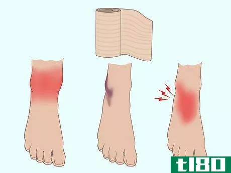Image titled Wrap an Ankle with an ACE Bandage Step 10