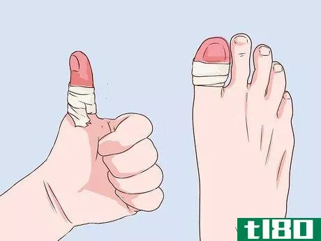 Image titled Bandage Fingers or Toes Step 16