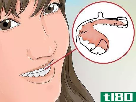 Image titled Avoid Getting Braces Step 4