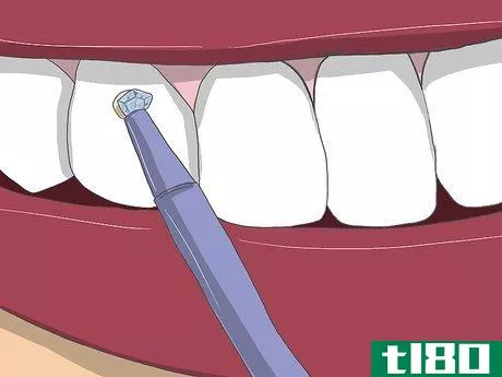 Image titled Apply Tooth Gems Step 13