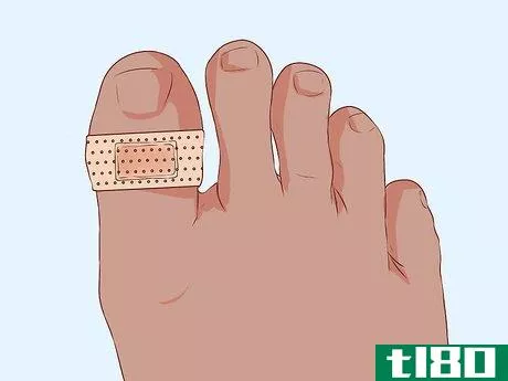 Image titled Bandage Fingers or Toes Step 11