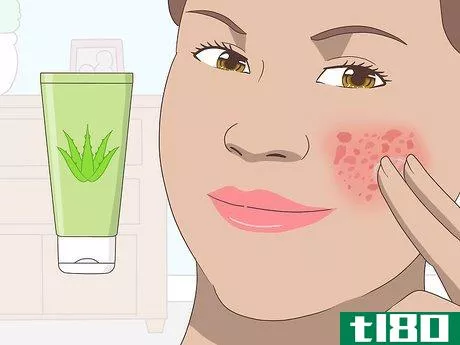 Image titled Use Aloe Vera Gel on Your Face Step 8