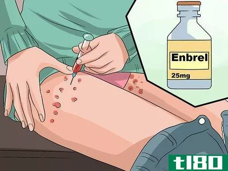 Image titled Avoid Psoriasis Vaccine Complications Step 8