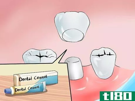 Image titled Avoid Dental Crown Problems Step 3