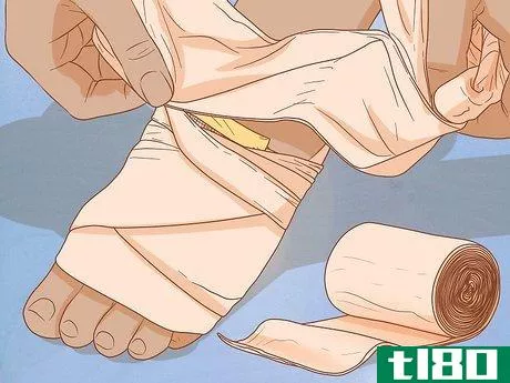 Image titled Apply Different Types of Bandages Step 9