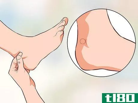 Image titled Use Acupressure to Induce Labour Step 9