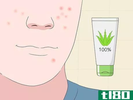 Image titled Use Aloe Vera Gel on Your Face Step 5