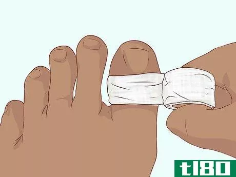 Image titled Bandage Fingers or Toes Step 14