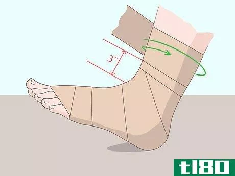 Image titled Wrap an Ankle with an ACE Bandage Step 6