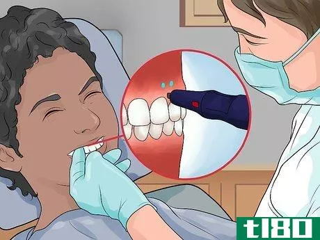 Image titled Avoid Getting Braces Step 7