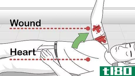 Image titled Attend to a Stab Wound Step 10