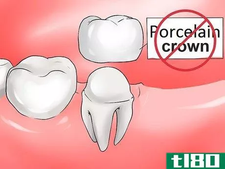 Image titled Avoid Dental Crown Problems Step 4