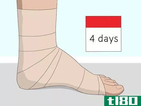 Image titled Wrap an Ankle with an ACE Bandage Step 11