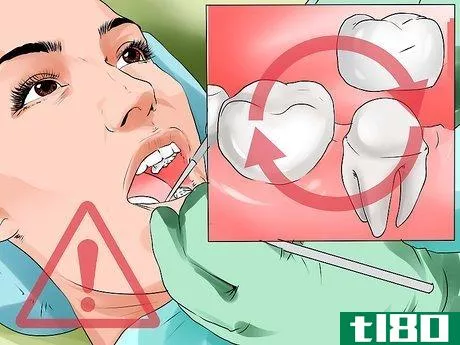 Image titled Avoid Dental Crown Problems Step 10