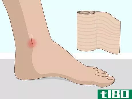 Image titled Wrap an Ankle with an ACE Bandage Step 9