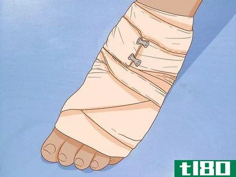 Image titled Apply Different Types of Bandages Step 10