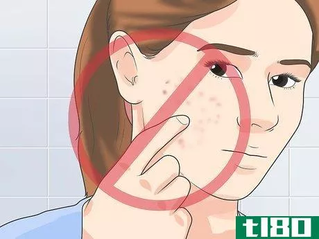 Image titled Treat Cystic Acne Naturally Step 18