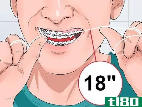 Image titled Clean Teeth With Braces Step 5