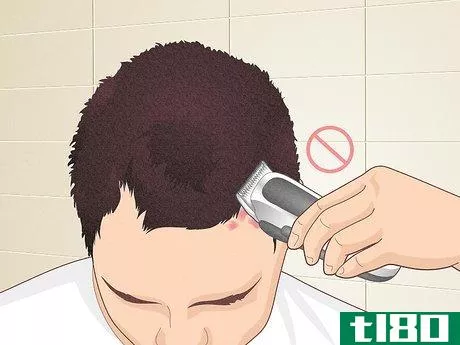 Image titled Bumps on Scalp Step 10