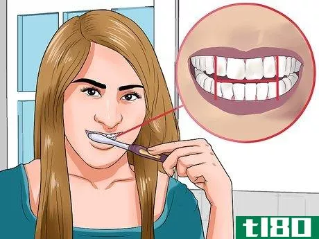 Image titled Clean Teeth With Braces Step 3