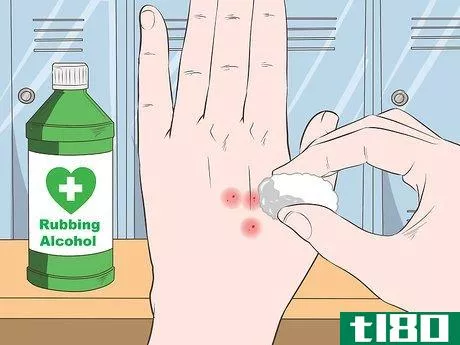 Image titled Stop Mosquito Bites from Itching Step 9