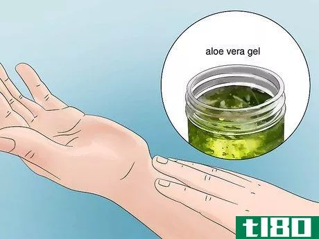 Image titled Treat Flea Bites Step 6