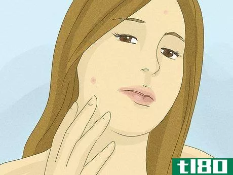 Image titled Stop Picking at Acne Step 7