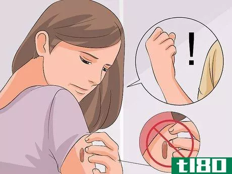 Image titled Stop Picking Your Scabs Step 11