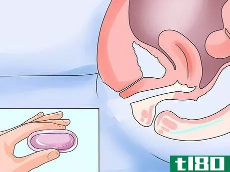 Image titled Treat Vaginal Dryness During Menopause Step 8