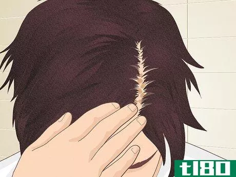 Image titled Bumps on Scalp Step 3