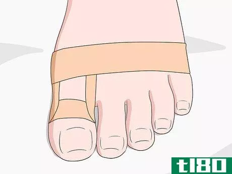 Image titled Stop a Bunion from Growing Step 9