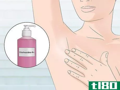 Image titled Stop Armpit Pimples Step 2