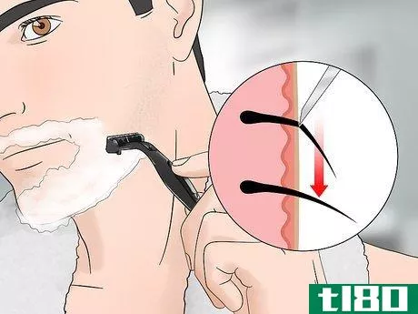 Image titled Stop Itching After Shaving Step 15