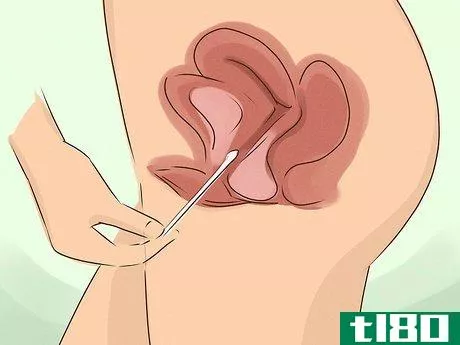 Image titled Test Vaginal pH Step 5