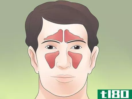 Image titled Stop Sinus Headaches Step 3