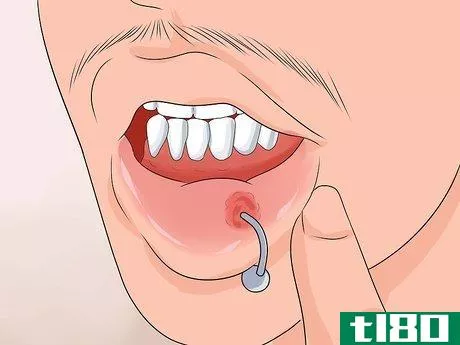 Image titled Take Care of a Lip Piercing Step 4