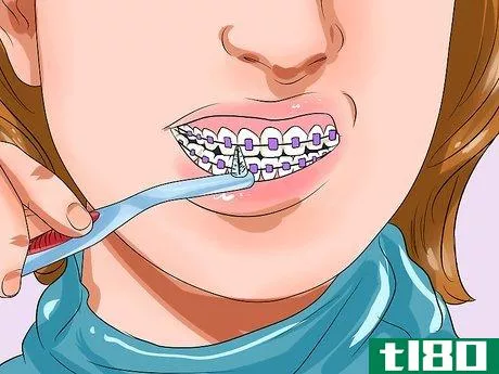 Image titled Clean Teeth With Braces Step 4