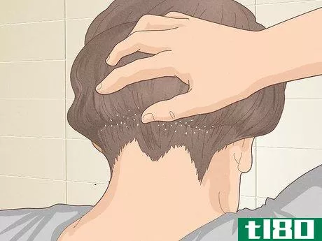 Image titled Bumps on Scalp Step 5