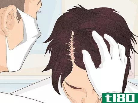 Image titled Bumps on Scalp Step 15